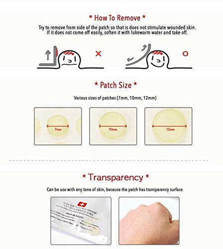 Parches Acne, Parche para acné, Acné espinilla Patch, Parches Granos, Parche absorbente de acné, Acné Hidrocoloide para Tratamiento de Espinilla - Cualquier piel (Beige)