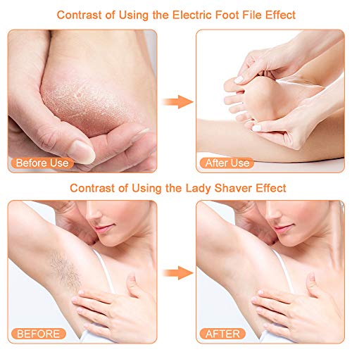 Pedicura Electrico, Afeitadora Eléctrica para Mujer,Impermeable Lima Eléctrica Pies para Eliminar Callos Herramientas de Pedicura Recargables con 4 Recambios,Quitar la Piel Muerta,Depiladora de Bikini