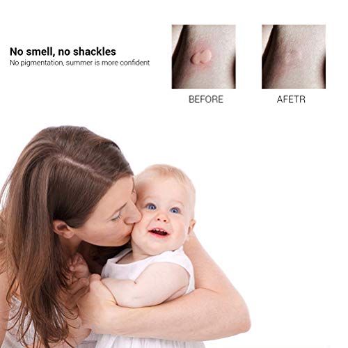 Picaduras de mosquito Stichheiler contra picazón, ardor, dolor e hinchazón debido a picaduras de insectos