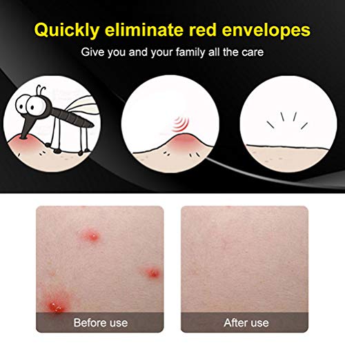 Picaduras de mosquito Stichheiler contra picazón, ardor, dolor e hinchazón debido a picaduras de insectos