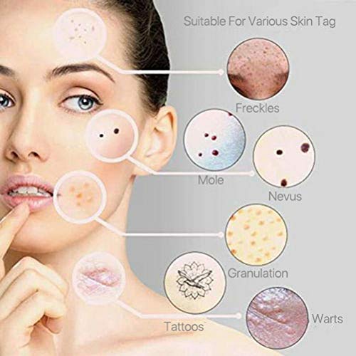 Pluma de terapia de luz azul, Nuevo bolígrafo de terapia de luz azul para venas varicosas, eliminación de arrugas de cicatrices suaves, borrador de venas, eliminación de venas de color azul claro