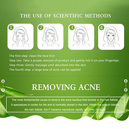 Pretty Comy Esencia de aloe vera para la eliminación de la solución del acné básica para el tratamiento antiinflamatorio de las espinillas of Control del aceite esencial del aceite hidratante