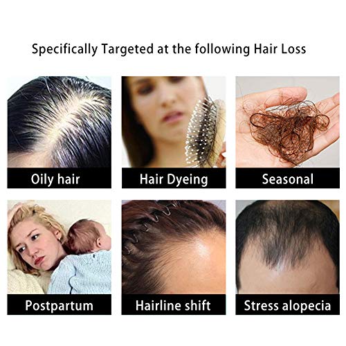 Profesional Champú, Repair Champú, Jengibre Champú, Hair Shampoo, para restaurar el cabello, Cabellos dañados y secos, Reduce la perdida de cabello y mantiene la densidad del cabello fino