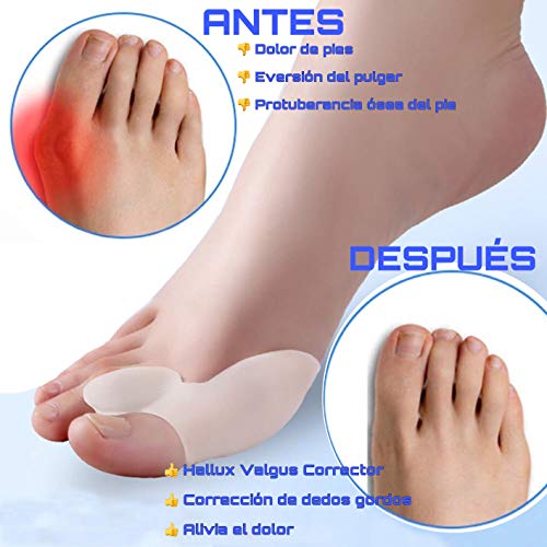 Protector de juanetes | corrector hallux valgus de gel | separador dedos | juanetes corrector nocturno y dia | corrector dedo de pies | almohadillas alivia dolor | top 2020 productos ortopédicos