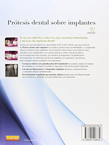 Prótesis dental sobre implantes - 2º Edición