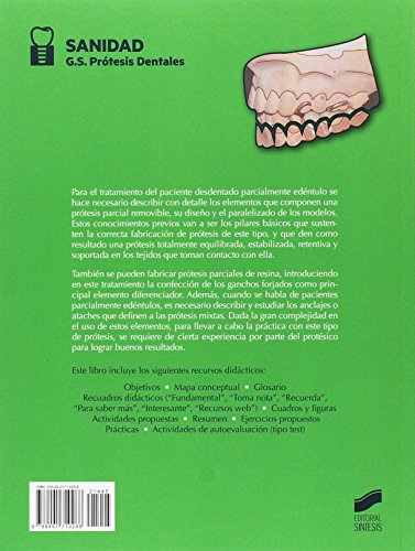 Prótesis parciales removibles metálicas, de resina y mixtas: 45 (Sanidad)