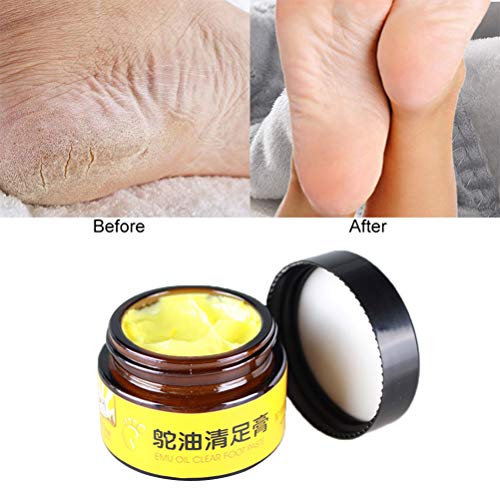 Pywee Crema de Masaje para el Cuidado de los pies con Aceite de emú Crema antimicótica para el Tratamiento de los pies con Alivio de la picazón