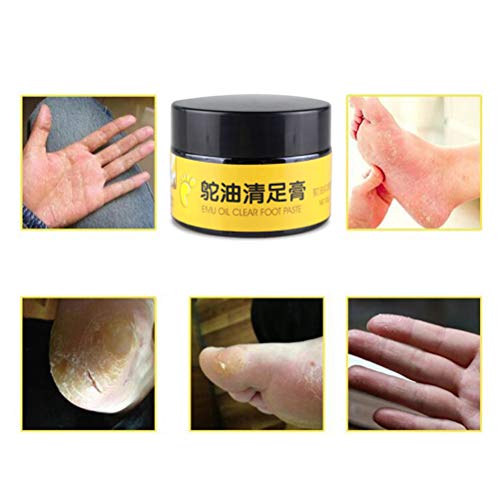 Pywee Crema de Masaje para el Cuidado de los pies con Aceite de emú Crema antimicótica para el Tratamiento de los pies con Alivio de la picazón