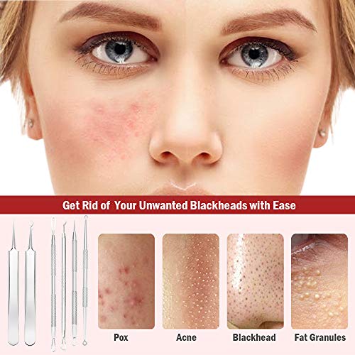 Quita Puntos Negros, Canwn Juego de 6 Acero Inoxidable Extracción de Puntos Negros y Granos Aguja Extractor Limpiador para Espinillas,Comedones,Acné