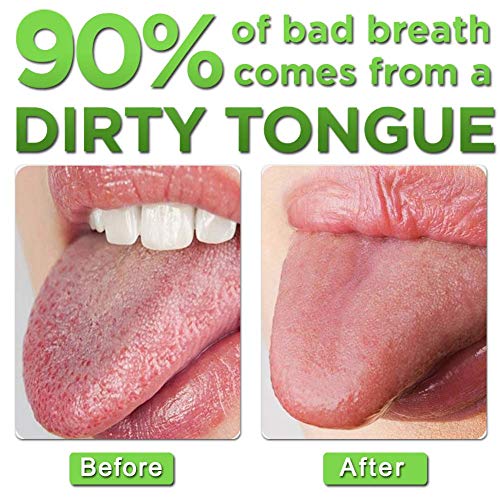 Raspador de lengua de Acero Inoxidable Xpassion Limpiador de Lengua 2 pack con Estuche, Limpieza Cepillo Lengua, El Mejor Remedio para Mal Aliento, Reutilizable Cepillo de Lengua Bucal para Salud Oral