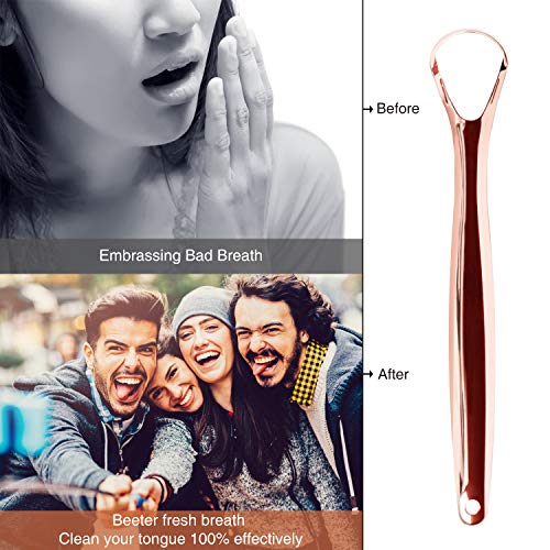 Raspador de lengua de Acero Inoxidable Xpassion Limpiador de Lengua 2 pack con Estuche, Limpieza Cepillo Lengua, El Mejor Remedio para Mal Aliento, Reutilizable Cepillo de Lengua Bucal para Salud Oral