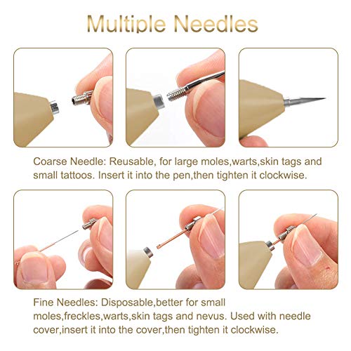 Removedor de manchas de piel, bolígrafo de eliminación de topo, 9 niveles de fuerza, USB portátil recargable para eliminación de verrugas faciales, pecas, nevus y pequeño tatuaje