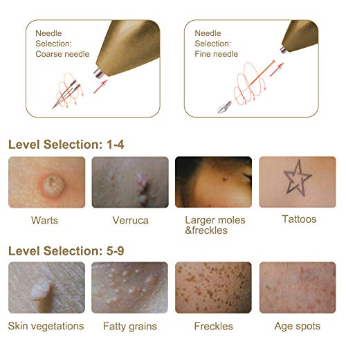 Removedor de manchas de piel, bolígrafo de eliminación de topo, 9 niveles de fuerza, USB portátil recargable para eliminación de verrugas faciales, pecas, nevus y pequeño tatuaje