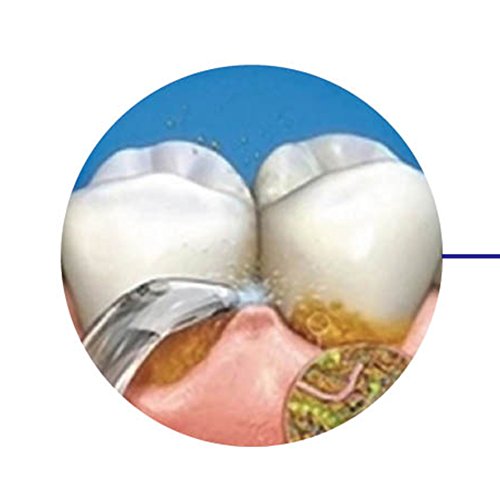 Rociador estándar de la higiene oral 4pcs para Waterpik WP-100 WP-450 WP-250 WP-300 WP-660 WP-900