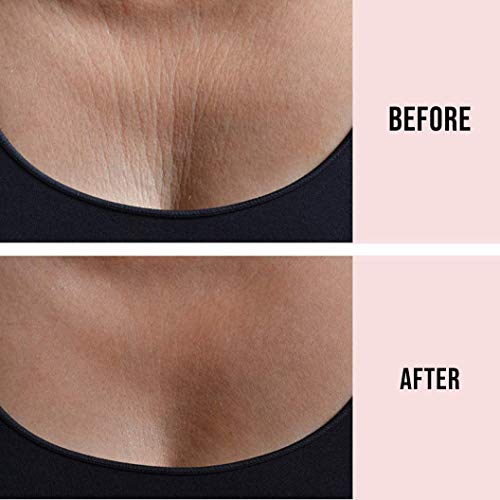 SandySkin Parche Antiarrugas par el Cuello - 2 Reutilizable Almohadillas de Silicona para las Arrugas del Cuello - Tratamiento y Prevención de las Arrugas + BONUS