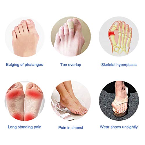 Separador dedos pie, Corrector De Juanetes para Noche y Día Set de 6 piezas, Protección de Juanetes y Hallux Valgus- 0% BPA - Talla universal