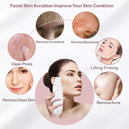 SEQI Limpiador Facial Ultrasónico, Peeling Ultrasónico Facial con 3 Modos,Skin Scrubber, USB Recargable, Exfoliación Facial Ultrasónica Limpiador de Poros para Limpieza Facial y Cuidado Facial(blanco)