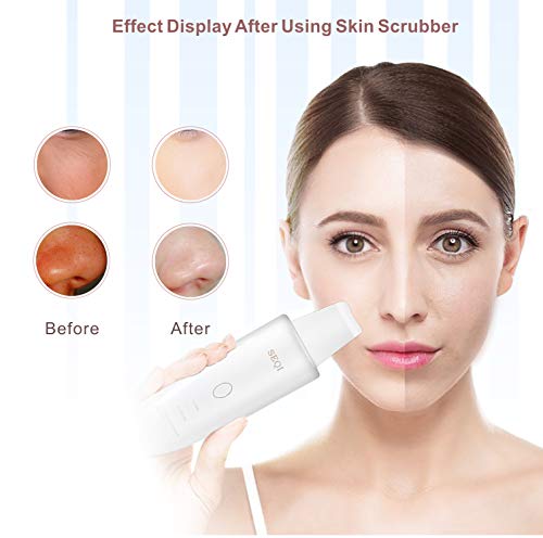 SEQI Limpiador Facial Ultrasónico, Peeling Ultrasónico Facial con 3 Modos,Skin Scrubber, USB Recargable, Exfoliación Facial Ultrasónica Limpiador de Poros para Limpieza Facial y Cuidado Facial(blanco)