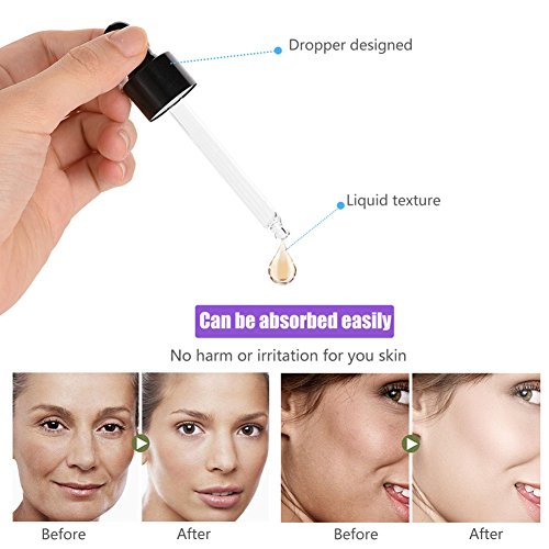 Serum Facial, Pure 5% Niacinamide Vitamina E y Acido Hialurónico Face Serum Whitening Crema Reafirmante Hidratante Antiarrugas