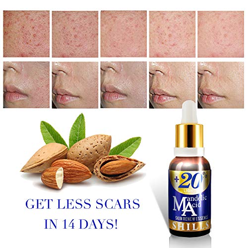 SHILLS+20% Mandelic Acid Skin Renew Essence, Vitamina E y ácido Mandelico,Remueve Acne, Arrrugas, anti enjecimiento, Iluminador facial. Esencia rejuvenecedora para la cara 30ml