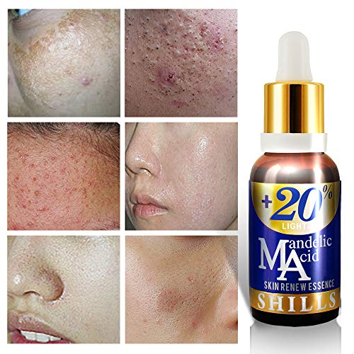 SHILLS+20% Mandelic Acid Skin Renew Essence, Vitamina E y ácido Mandelico,Remueve Acne, Arrrugas, anti enjecimiento, Iluminador facial. Esencia rejuvenecedora para la cara 30ml