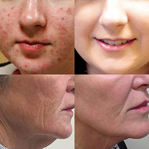 Shouhengda Hyaluronic Acid Face Serum, Vitamin C Serum Anti-Wrinkle Hyaluronic Acid Whitening Firming Freckle ayuda a eliminar las cicatrices del acné, arrugas, manchas para la cara/cuello /