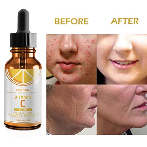Shouhengda Hyaluronic Acid Face Serum, Vitamin C Serum Anti-Wrinkle Hyaluronic Acid Whitening Firming Freckle ayuda a eliminar las cicatrices del acné, arrugas, manchas para la cara/cuello /