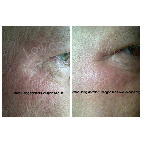 Skin Roller Collagen Serum 30ml