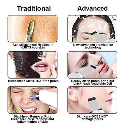Skin Scrubber, Etmury Peeling Ultrasónico Facial con 3 Modos, LCD Pantalla, USB Recargable, Equipo de Belleza Facial Multifuncional para Tratamiento de Exfoliación Hidratante y Lifting Facial