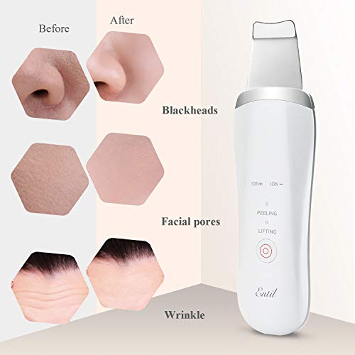 Skin Scrubber, Limpiador de la Piel Facial con EMS Masaje, 4 en 1 Espátula Facial Ultrasónica para Limpieza Profunda, Limpiador de Poros Espinilla Acné, Lifting Dispositivo de Belleza Facial con USB