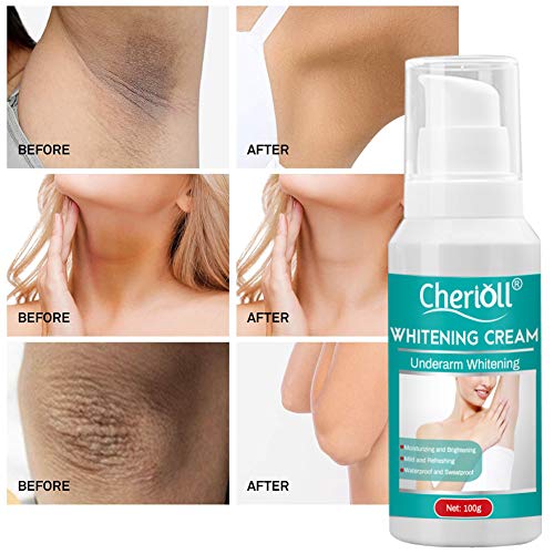 Skin Whitening Cream, Crema Blanqueadora, Skin Whitening Cream, Crema Blanqueadora Cuerpo y Aclarar las Manchas de la piel, Corporal para Piel Oscura, Cuello, 100g