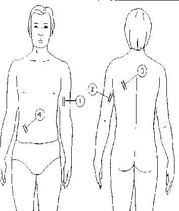 Slim Guide Idass - Adipómetro