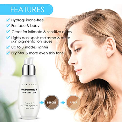 Suero aclarante, corrector de manchas oscuras Suero aclarante para rostro y cuerpo con ácido kójico, alfa arbutina, vitamina C, E, extracto natural contra el envejecimiento 50 ml