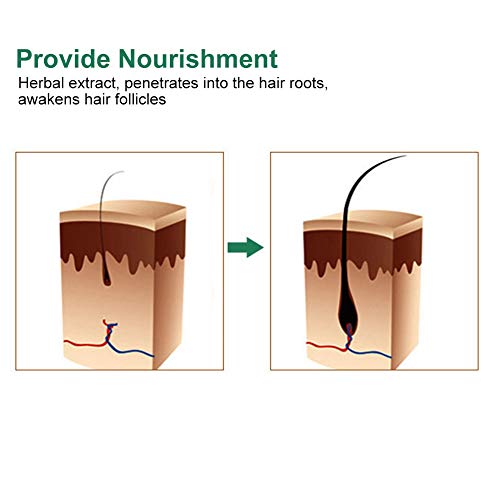 Suero de Aceite para la regeneración del cabello - Extracto de plantas naturales de jengibre para promover la absorción de nutrientes del cuero cabelludo