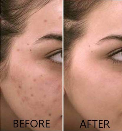 Suero de vitamina C 20 % puro ácido L-ascórbico, ácido ferúlico, vitamina E y ácido hialurónico para rostro y ojos, 30 ml, de Dr. Brenner