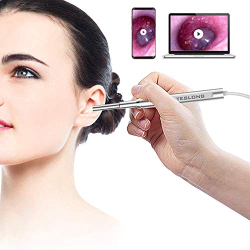 Teslong - Otoscopio USB, 4,3 mm, cámara de inspección con 6 luces LED, para Samsung, LG, Sony, Android, Mac y PC