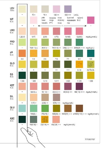 Test de orina Reactif con 11 parámetros - 25 tiras de test rápido de orina con escala de colores