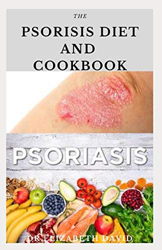 THE PSORIASIS DIET AND COOKBOOK: Dietary Guide For Preventing  and Healing Psoriasis : Includes Delicious Recipe ,Meal Plan and Cookbook