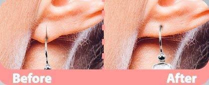 Tiras para las perforaciones de las orejas APRICOT, para disimular los lóbulos estirados y las perforaciones desgarradas. ¡Protección invisible de las perforaciones en la oreja!