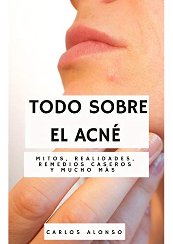 Todo sobre el acné: Mitos, realidades, remedios caseros y mucho más
