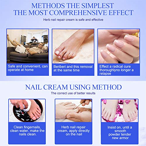 Tratamientos para uñas,Crema de uñas para pies Crema para el cuidado de la piel Crema de hongos para uñas Crema anti hongos para reparar las uñas