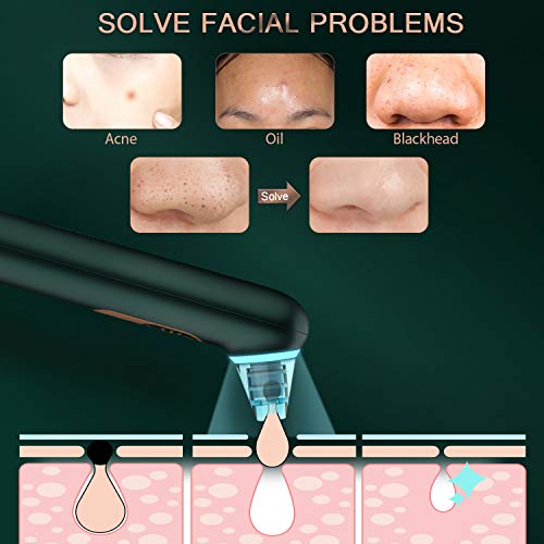 TURATA Limpiador de Poros, Eliminador de Puntos Negros 3 Niveles de La Succión Ajustable 4 Cabezas Reemplazables Luz Azul Anti Acné Eliminación para Eliminación de Espinillas y Acné (Esmeralda)