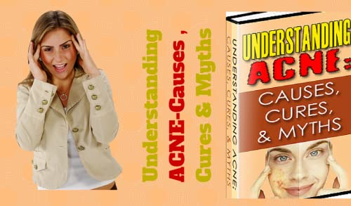 Understanding Acne Causes Cures And Myths