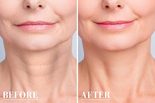 UNDOMIEL - Almohadillas de silicona para el pecho para mujer, antiarrugas, tratamiento médico, para el cuello, previene la elasticidad, reduce las líneas finas al dormir.