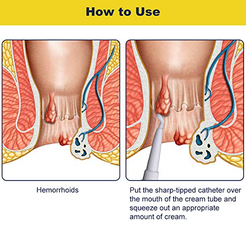 Ungüento para hemorroides, Crema Para Hemorroides Crema, Ungüento para hemorroides Ungüento Natural a Base de Plantas Crema para hemorroides Potente