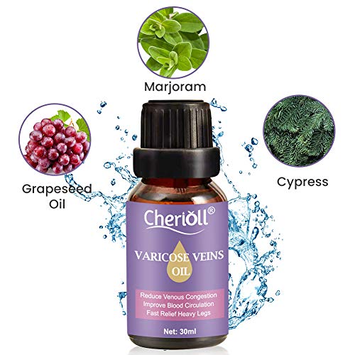 Varices, Venas Varicosas, Relieve Flebitis Angiitis, Inflamación, Alivio de Flebitis, Vasos Sanguíneos, Cuidado de Piernas Suave, Inflamación de vasos sanguíneos
