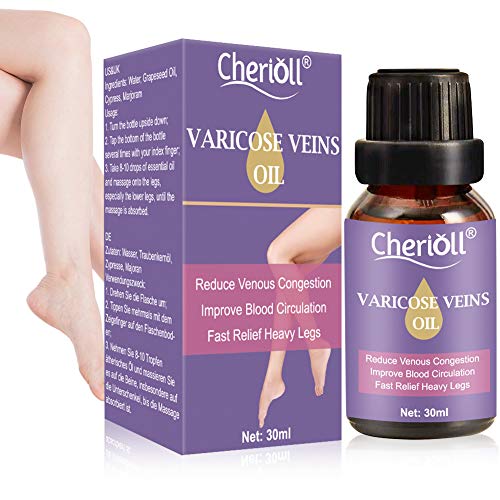 Varices, Venas Varicosas, Relieve Flebitis Angiitis, Inflamación, Alivio de Flebitis, Vasos Sanguíneos, Cuidado de Piernas Suave, Inflamación de vasos sanguíneos