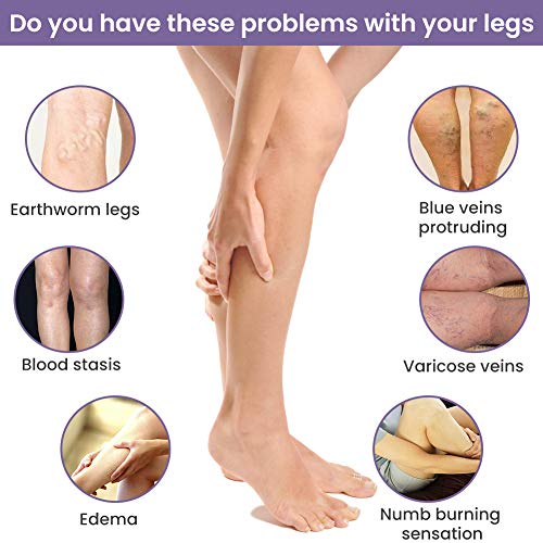 Varices, Venas Varicosas, Relieve Flebitis Angiitis, Inflamación, Alivio de Flebitis, Vasos Sanguíneos, Cuidado de Piernas Suave, Inflamación de vasos sanguíneos