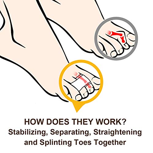 Welnove - 6 enderezadores de pie para dedo en martillo, férulas de dedo, vendajes acolchados, para corregir dedos de los pies con fracturas, torcidos y superpuestos