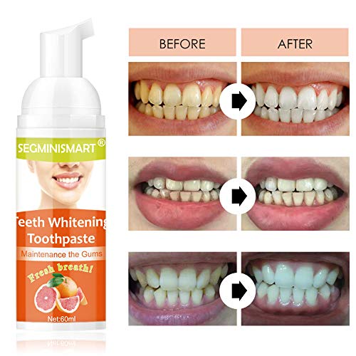 Whitening Toothpaste, Blanqueador Dental, Baking Soda Toothpaste, Pasta de Dientes Sin Flúor, Intensive Stain Removal Whitening Toothpaste, Prevenir la Caries Dental, Eliminación de Manchas